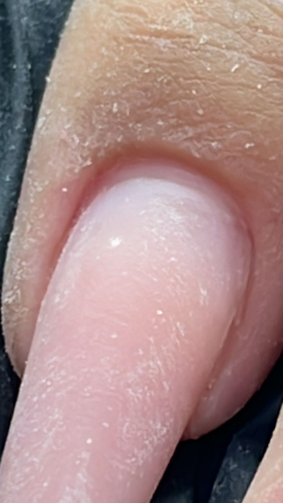Cuticulagem
